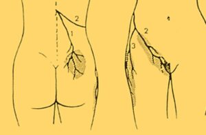 innervazione T12 L1